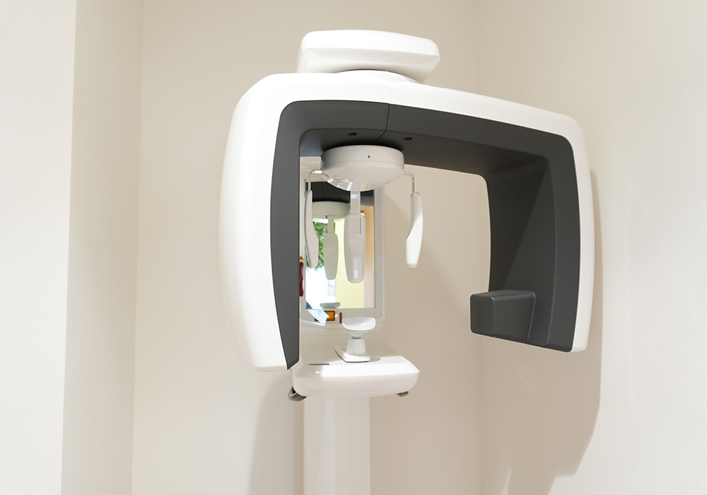 デジタルレントゲン