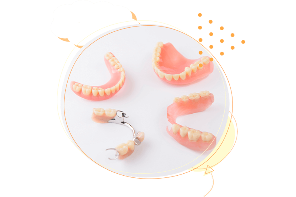 義歯（入れ歯）